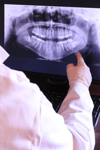 Tooth Infection Emergency Dentist in MN
